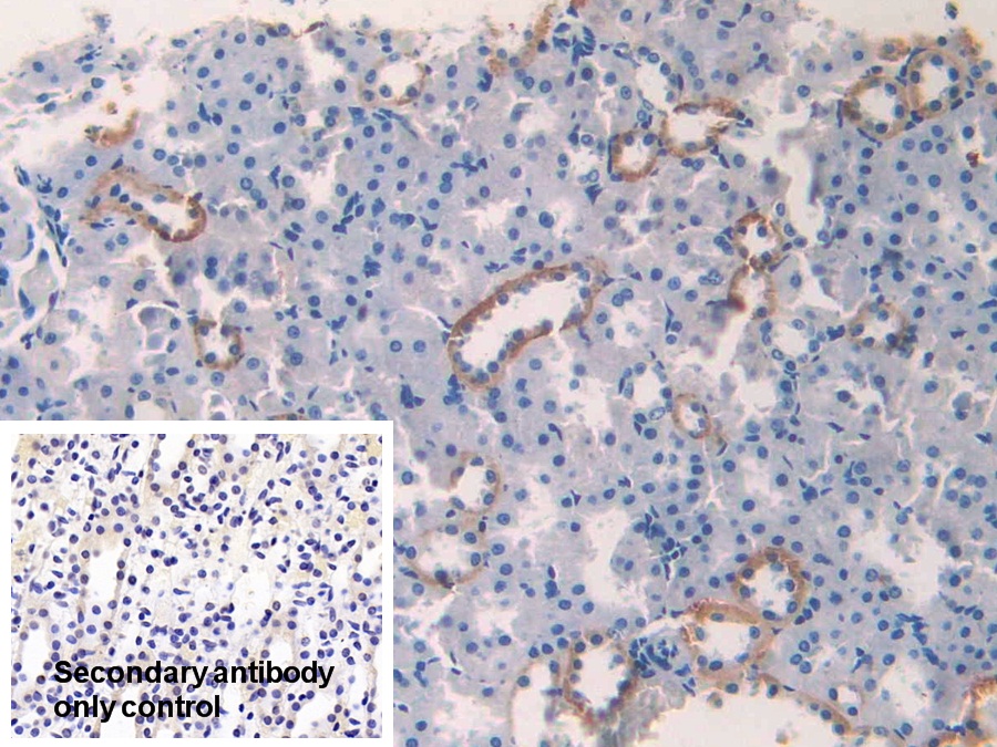 Polyclonal Antibody to Casein Kinase 1 Alpha 1 (CSNK1a1)