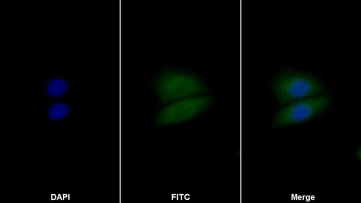 Polyclonal Antibody to Casein Kinase 1 Alpha 1 (CSNK1a1)