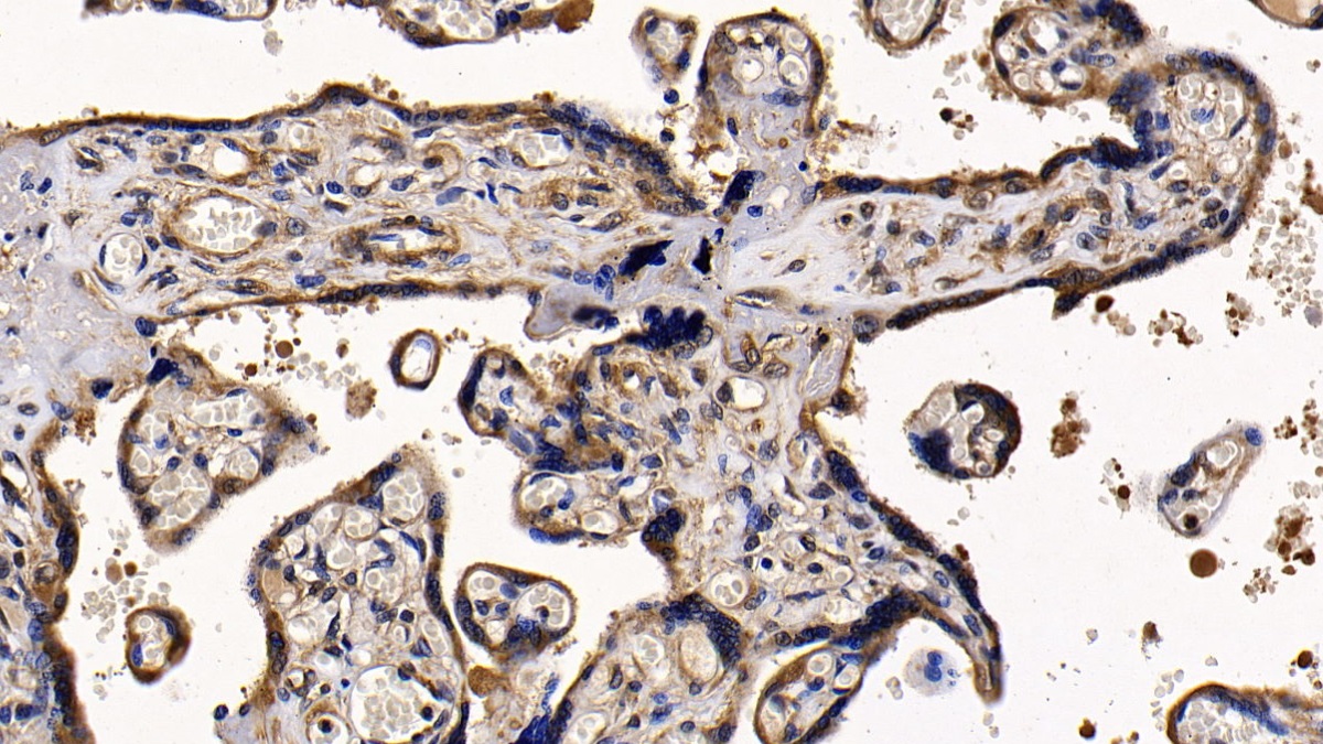 Polyclonal Antibody to Toll Like Receptor 2 (TLR2)