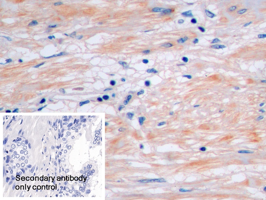 Polyclonal Antibody to Cross Linked C-Telopeptide Of Type I Collagen (CTXI)