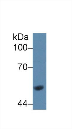 Polyclonal Antibody to Glucokinase (GCK)