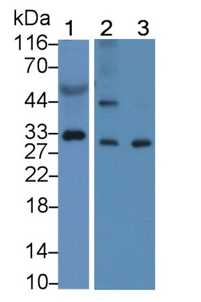 Polyclonal Antibody to Kallikrein 11 (KLK11)