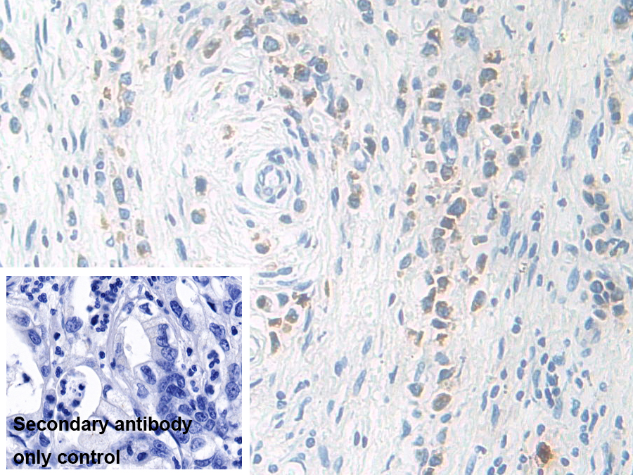 Polyclonal Antibody to Kallikrein 11 (KLK11)