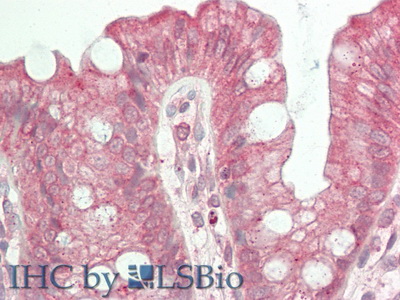 Polyclonal Antibody to Slit Homolog 2 (Slit2)