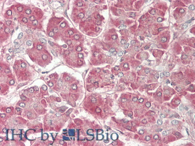 Polyclonal Antibody to Slit Homolog 2 (Slit2)