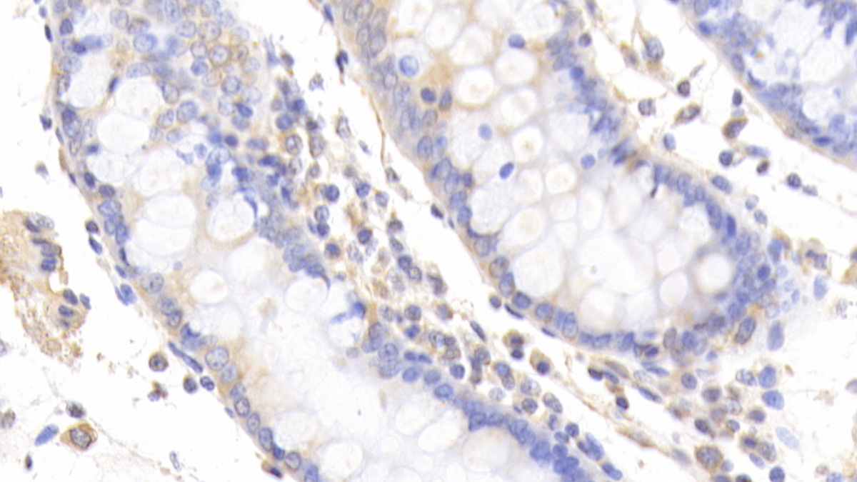 Polyclonal Antibody to Slit Homolog 2 (Slit2)