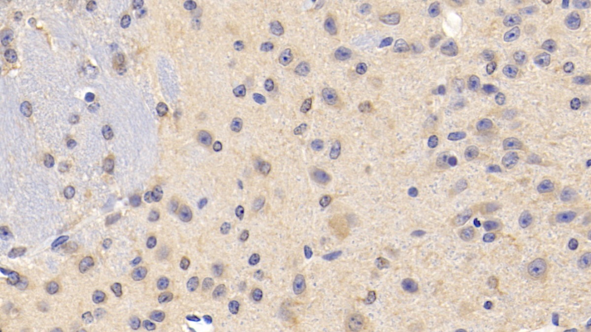 Polyclonal Antibody to Slit Homolog 2 (Slit2)