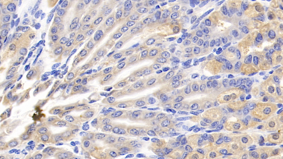 Polyclonal Antibody to Slit Homolog 2 (Slit2)