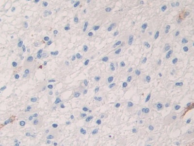 Polyclonal Antibody to Coagulation Factor V (F5)