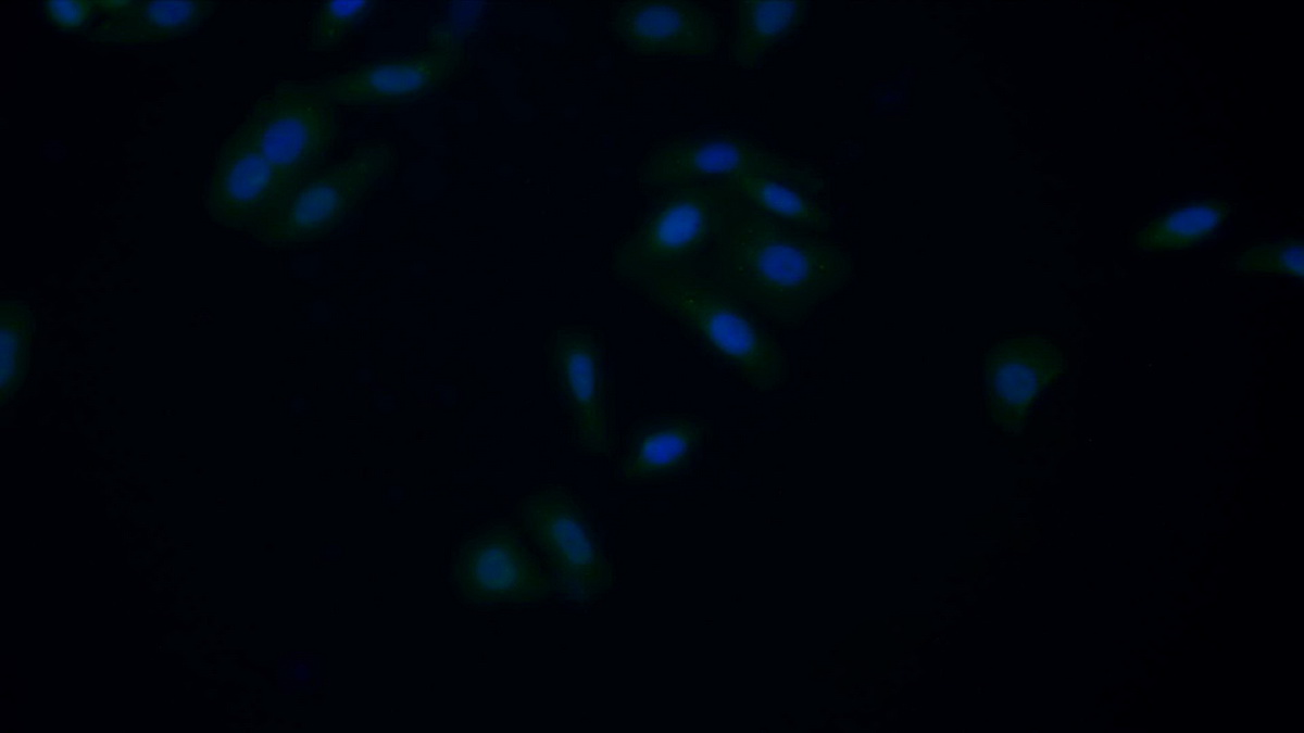 Polyclonal Antibody to Coagulation Factor V (F5)