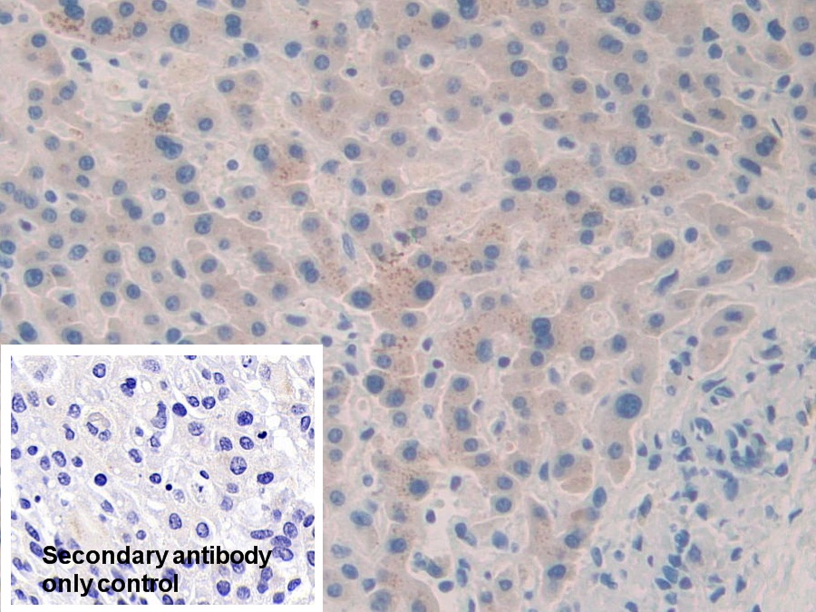 Polyclonal Antibody to Coagulation Factor V (F5)