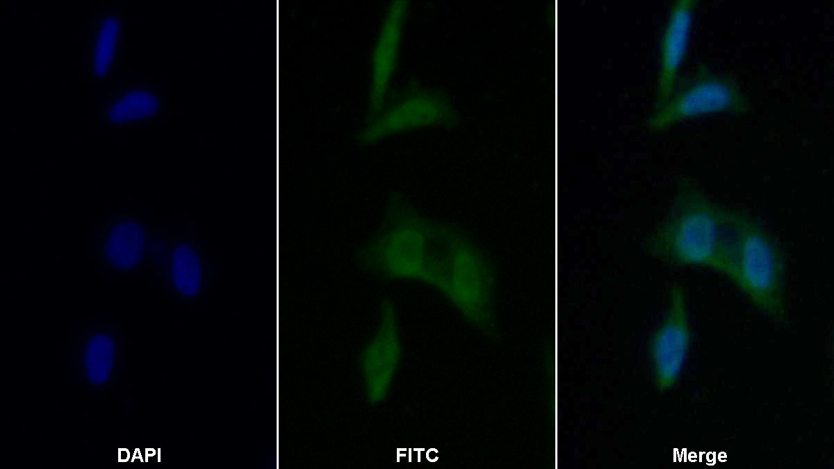 Polyclonal Antibody to Coagulation Factor V (F5)