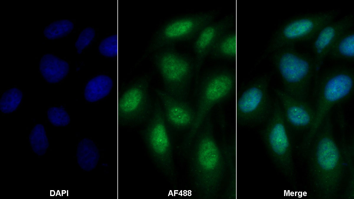 Polyclonal Antibody to Coagulation Factor V (F5)