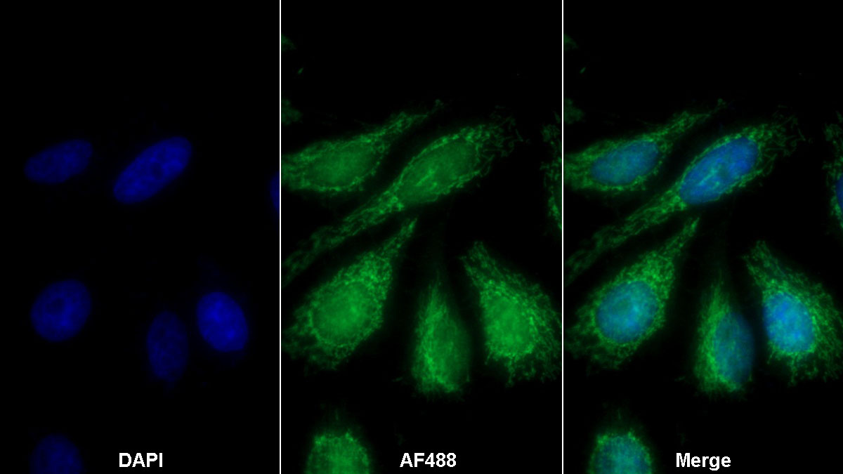 Polyclonal Antibody to Coagulation Factor V (F5)