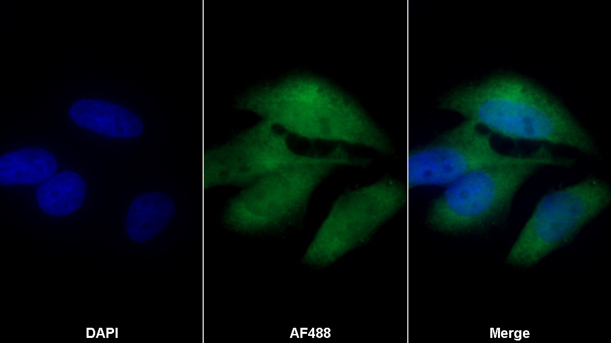 Polyclonal Antibody to Coagulation Factor V (F5)