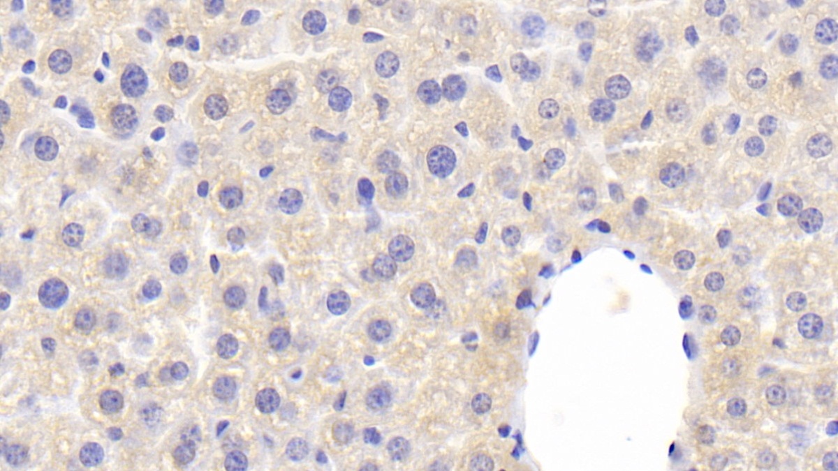 Polyclonal Antibody to Coagulation Factor V (F5)