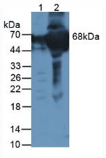 Polyclonal Antibody to Coagulation Factor XII (F12)