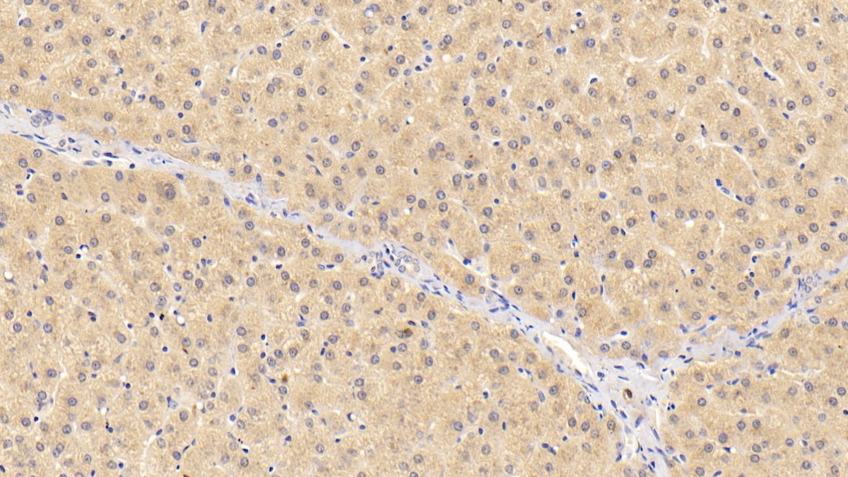 Polyclonal Antibody to Coagulation Factor XII (F12)