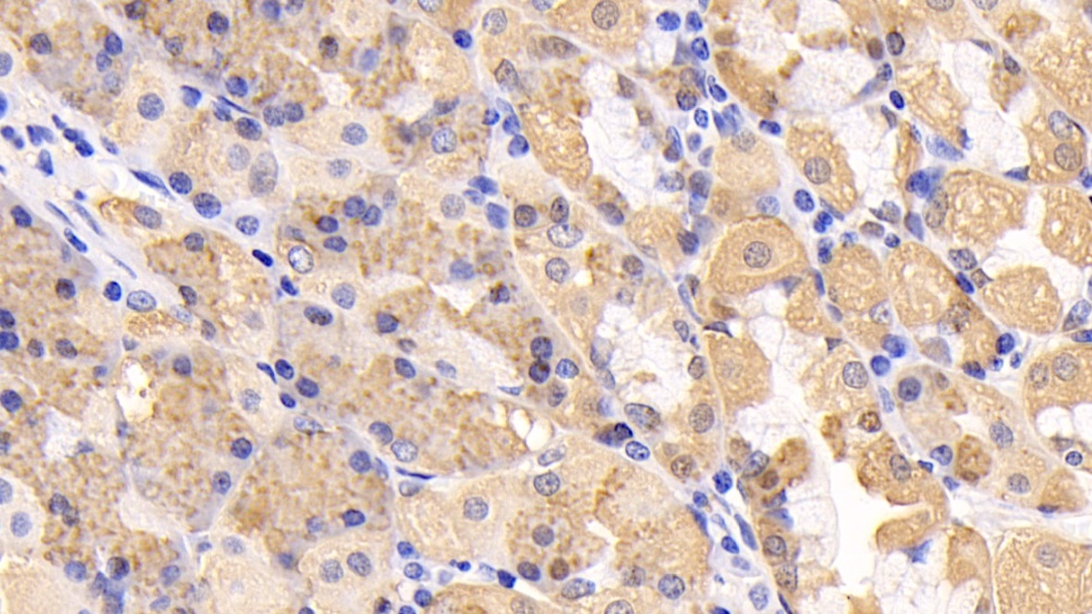 Polyclonal Antibody to Protein Kinase, AMP Activated Alpha 1 (AMPK Alpha 1)