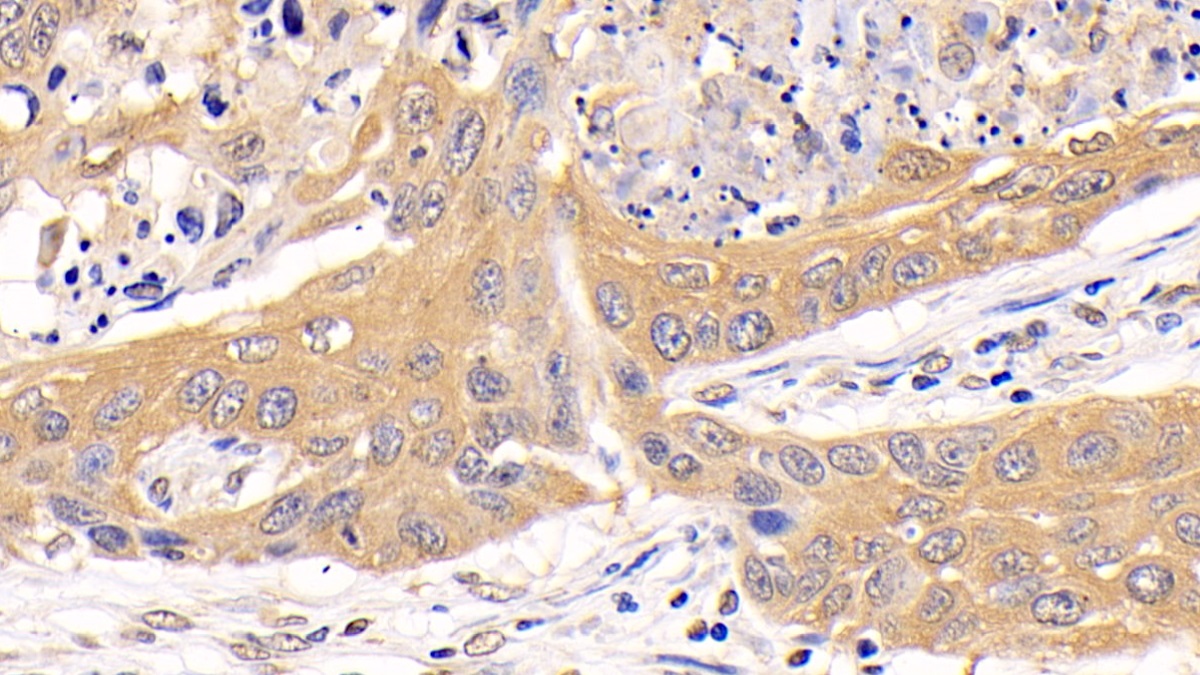 Polyclonal Antibody to Protein Kinase, AMP Activated Alpha 1 (AMPK Alpha 1)