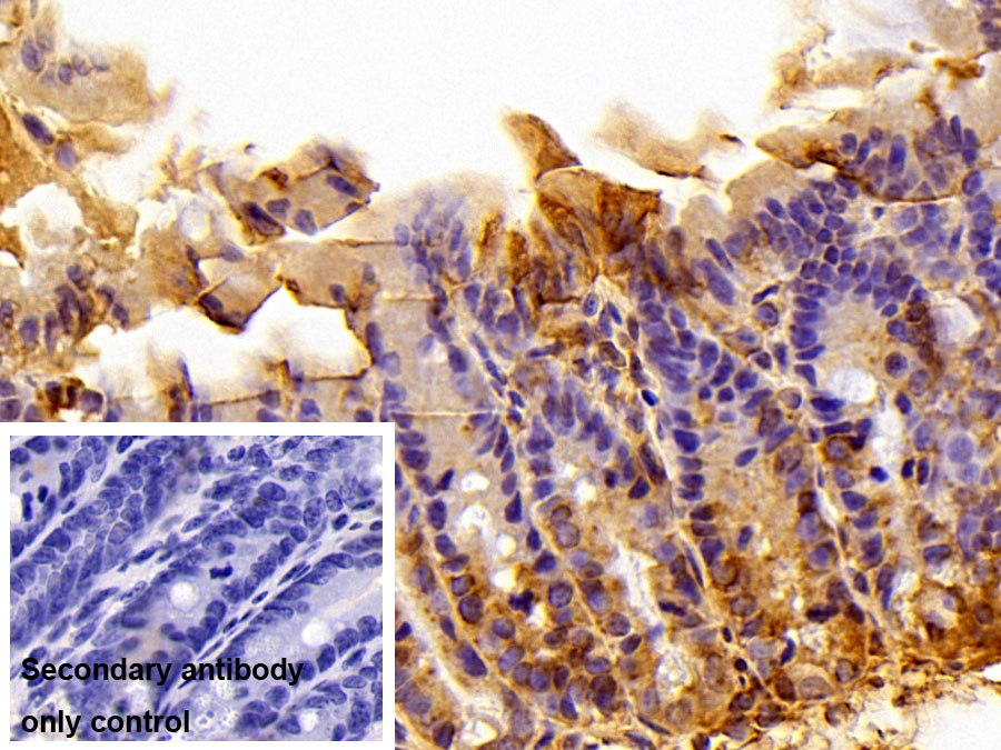 Polyclonal Antibody to Protein Kinase, AMP Activated Alpha 1 (AMPK Alpha 1)