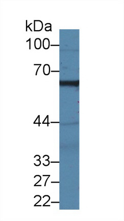 Polyclonal Antibody to Membrane Protein, Palmitoylated 2 (MPP2)