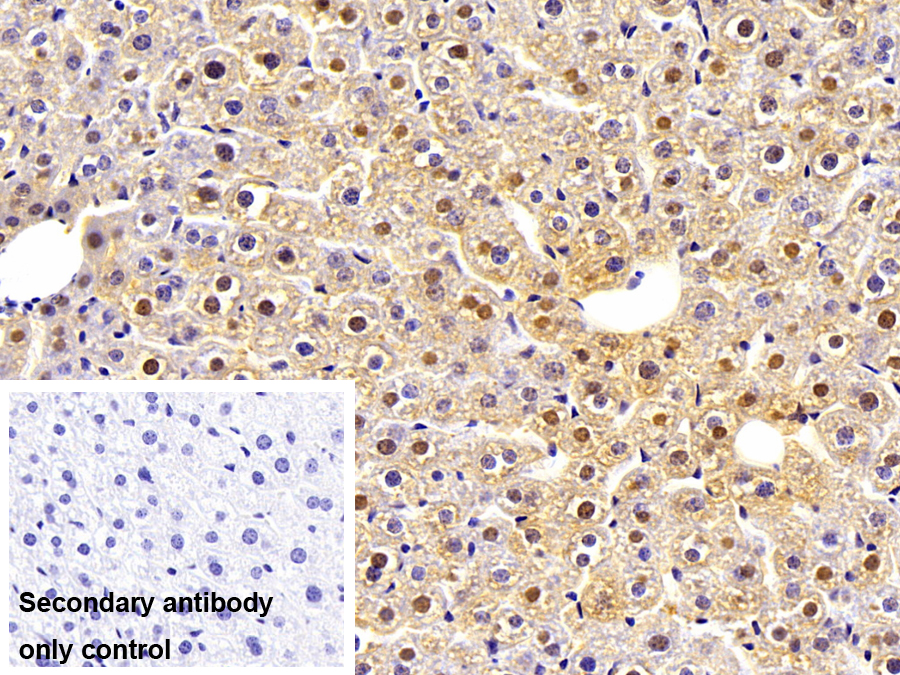 Polyclonal Antibody to Alcohol Dehydrogenase 1 (ADH1)