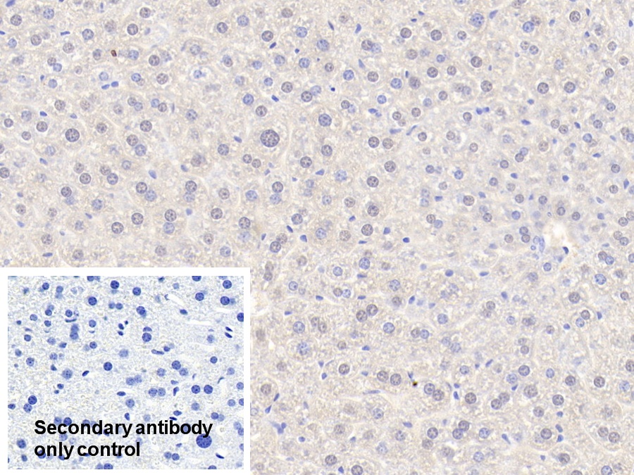 Polyclonal Antibody to Alcohol Dehydrogenase 1 (ADH1)