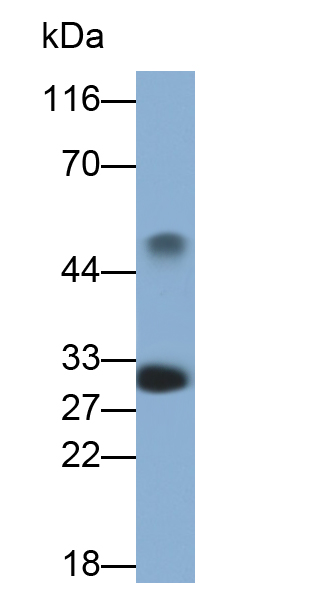 Polyclonal Antibody to Mucin 5 Subtype B (MUC5B)