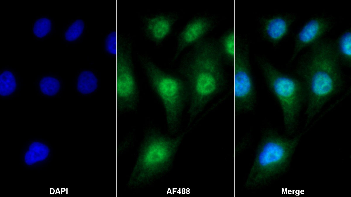 Polyclonal Antibody to TGF Beta Inducible Early Response Gene 1 (TIEG1)