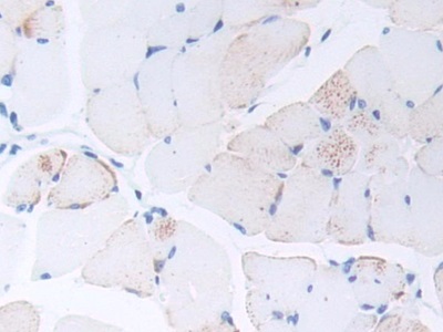 Polyclonal Antibody to Procalcitonin (PCT)