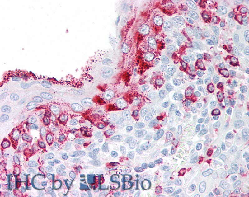 Polyclonal Antibody to Kallikrein 8 (KLK8)