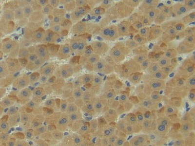 Polyclonal Antibody to Neuropilin 1 (NRP1)