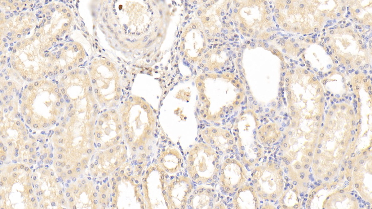 Polyclonal Antibody to Neuropilin 1 (NRP1)