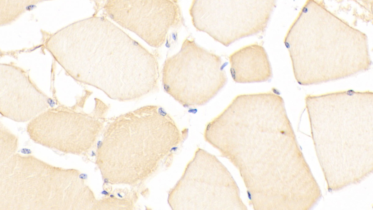 Polyclonal Antibody to Neuropilin 1 (NRP1)