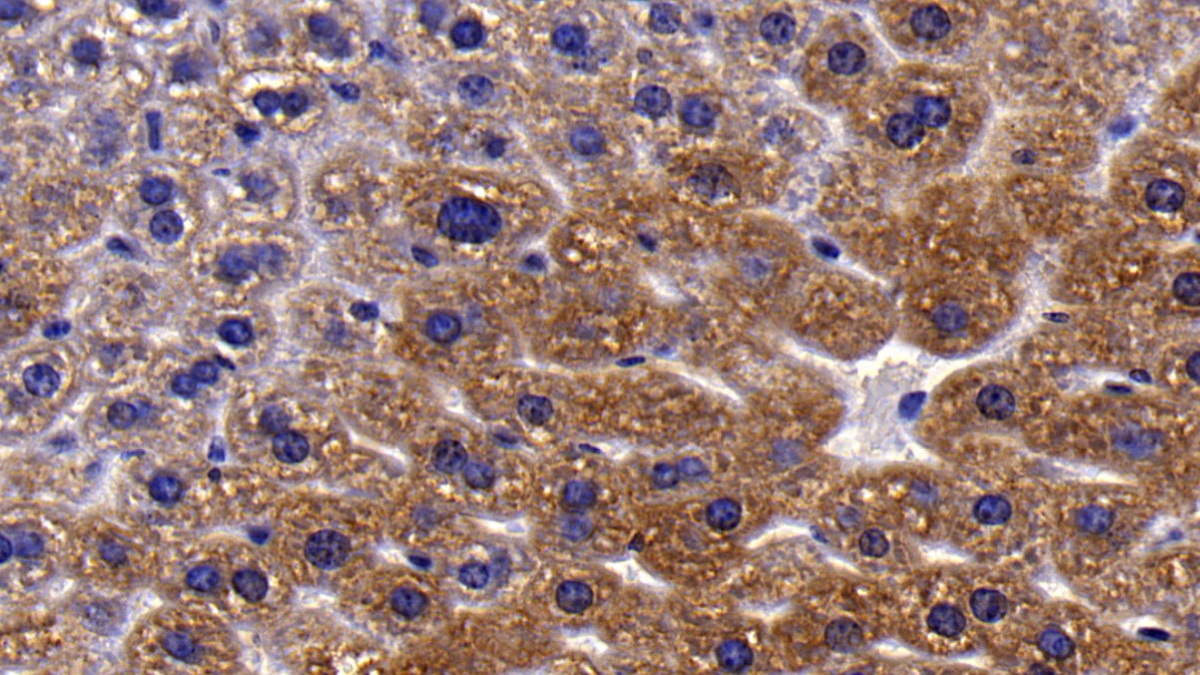 Polyclonal Antibody to Neuropilin 1 (NRP1)