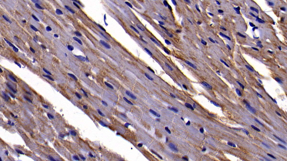 Polyclonal Antibody to Neuropilin 1 (NRP1)