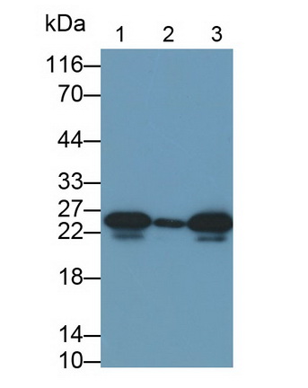 Polyclonal Antibody to Heat Shock Protein 27 (Hsp27)