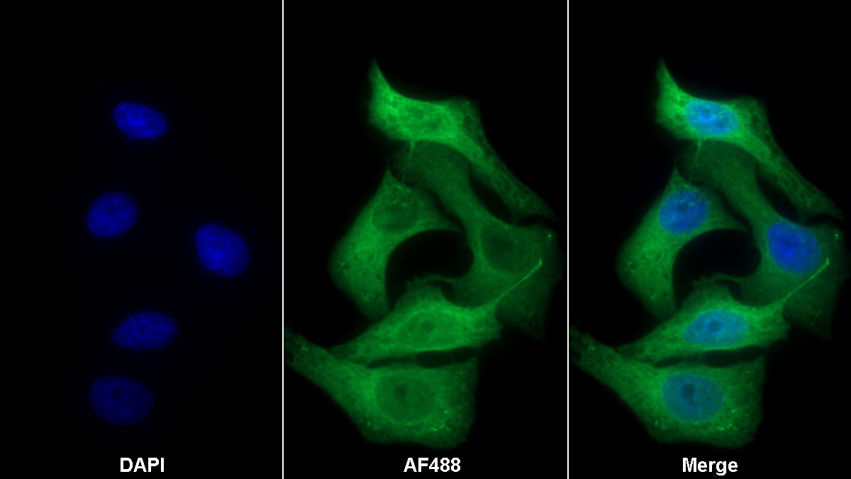 Polyclonal Antibody to Heat Shock Protein 27 (Hsp27)