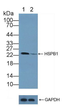 Polyclonal Antibody to Heat Shock Protein 27 (Hsp27)