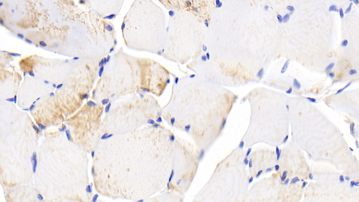 Polyclonal Antibody to Heat Shock Protein 27 (Hsp27)