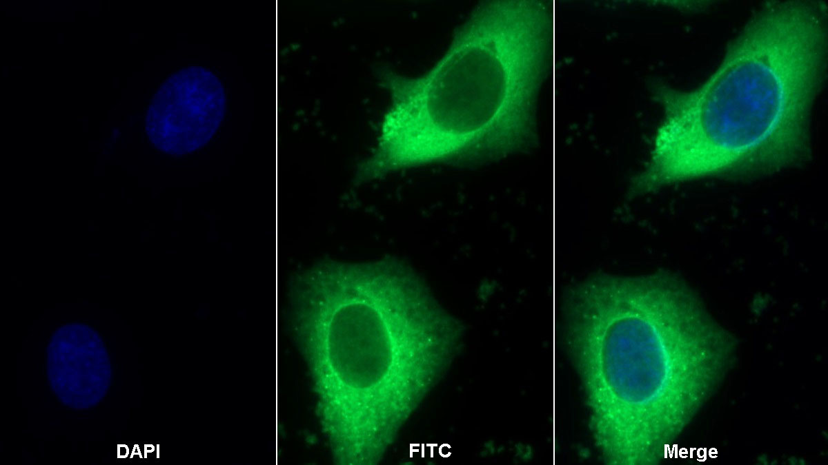 Polyclonal Antibody to Heat Shock Protein 27 (Hsp27)