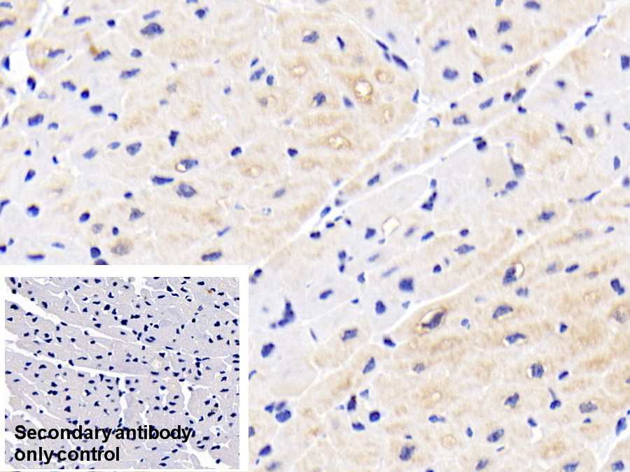 Polyclonal Antibody to Heat Shock Protein 27 (Hsp27)