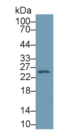 Polyclonal Antibody to Heat Shock Protein 27 (Hsp27)