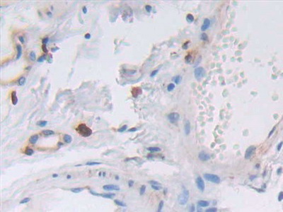 Polyclonal Antibody to Von Willebrand Factor A Domain Containing Protein 3A (vWA3A)