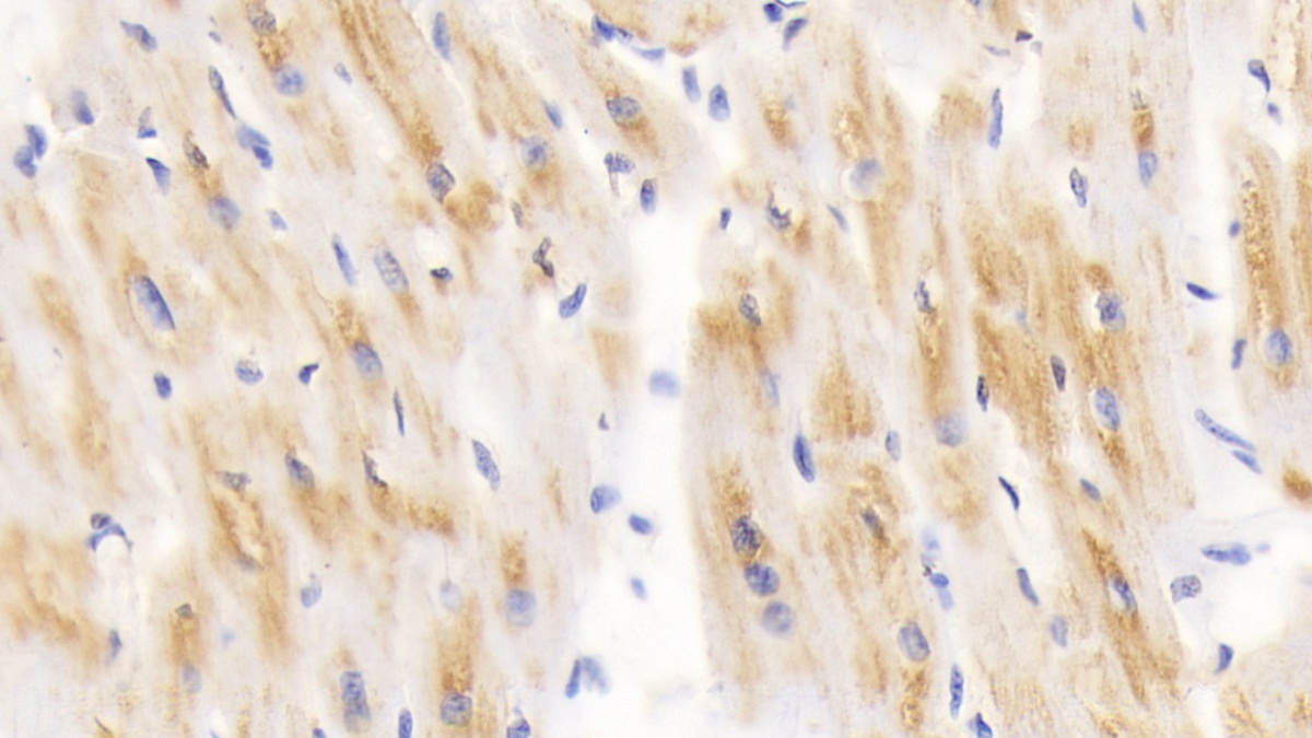 Polyclonal Antibody to Dihydrolipoyl Transacetylase (DLAT)