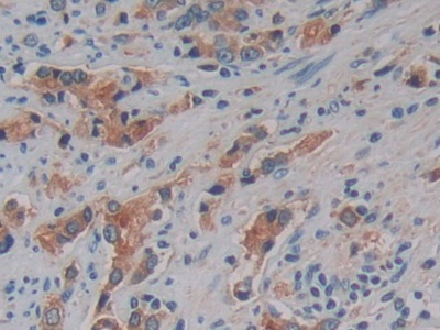 Polyclonal Antibody to Kallikrein 10 (KLK10)