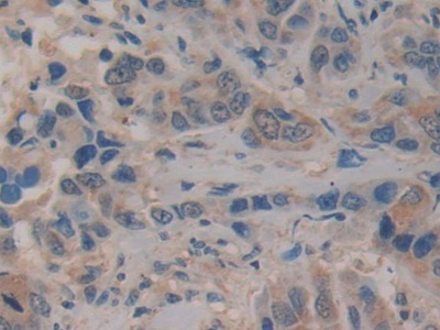 Polyclonal Antibody to Kallikrein 10 (KLK10)