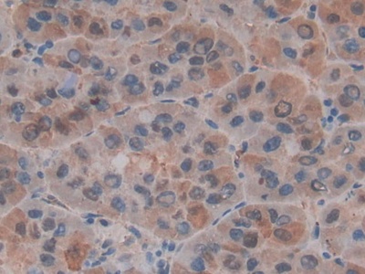 Polyclonal Antibody to Macrophage Migration Inhibitory Factor (MIF)