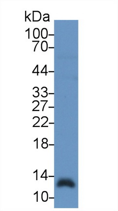 Polyclonal Antibody to Macrophage Migration Inhibitory Factor (MIF)